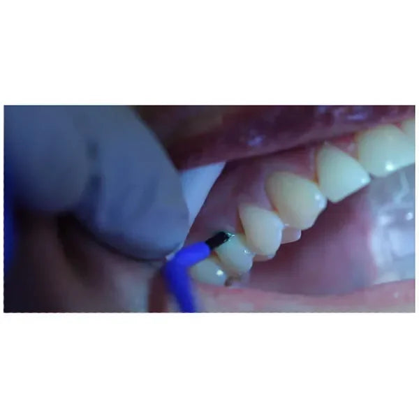 GC Dentin Conditioner (Pack of 10)