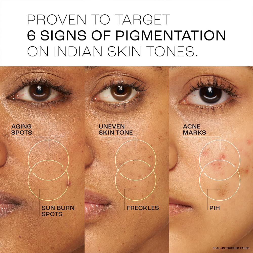 Lakmé Perfect Radiance Pigmentation Treatment Day Gel Crème with 10% Niacinamide Resorcinol Complex & 7 Antioxidants – 50 g