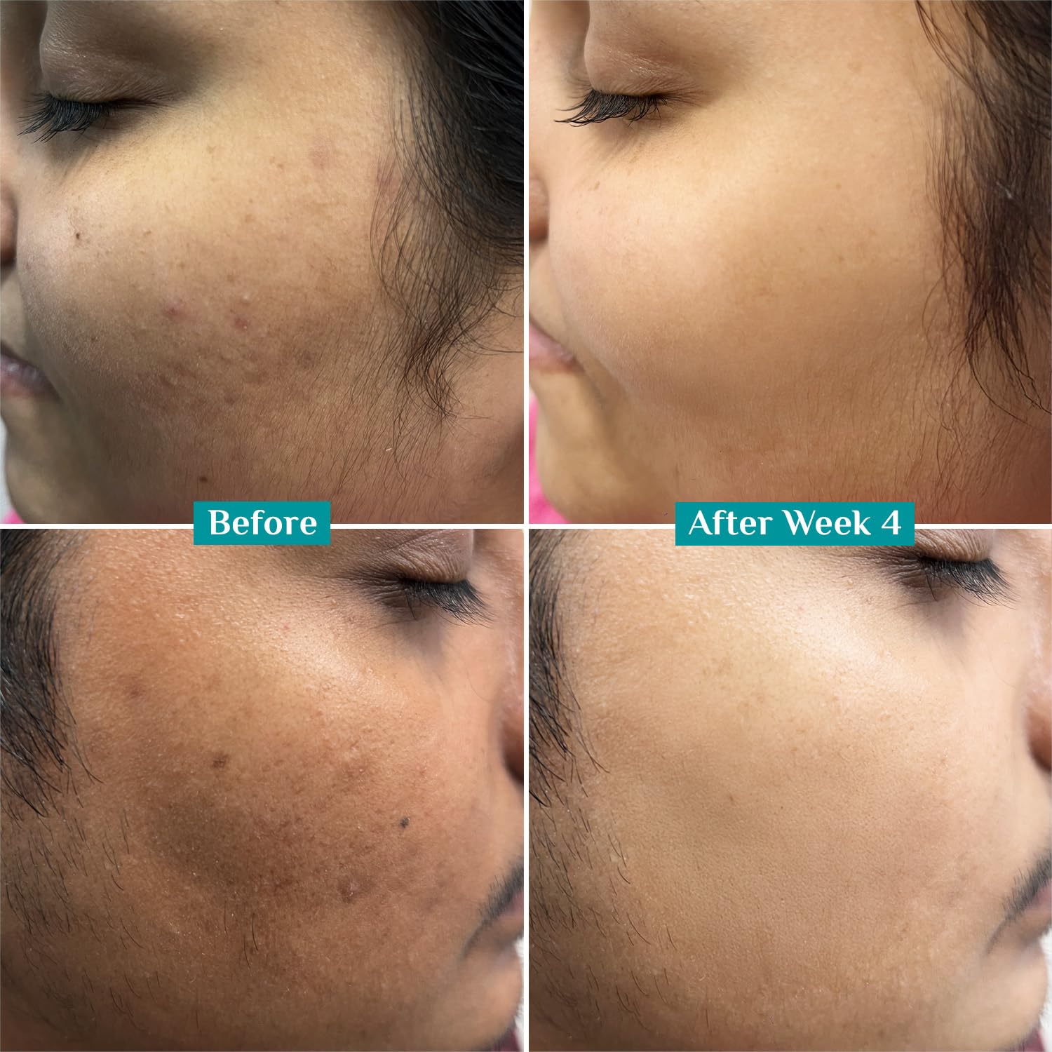 Pilgrim 10% Vitamin C Face Serum 30ml | 5% Niacinamide, Hyaluronic Acid & Glycolic Acid | Brightening Serum for All Skin Types