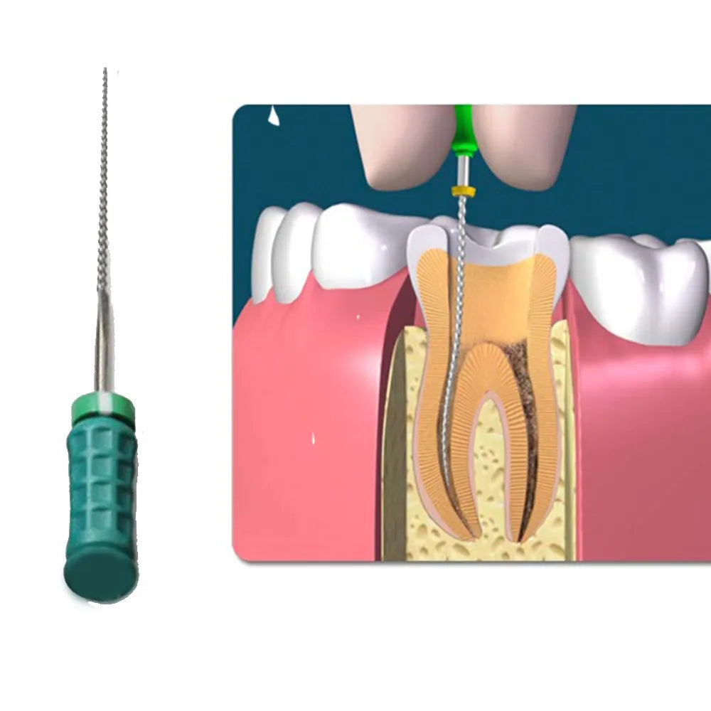 Dentsply M-Access K-Files 25mm