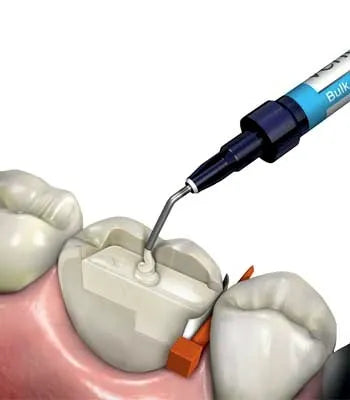 Ivoclar Te-Econom Flow Shade A2 & A3