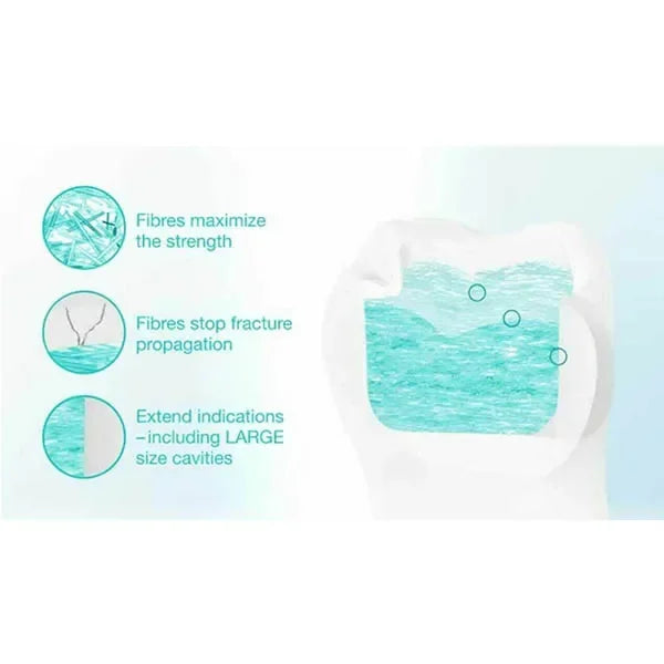GC Everx Posterior Fiber Reinforced Composite Dentin Replacement