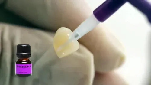 Ivoclar Monobond N 5gm Universal Dental Bonding Agent++